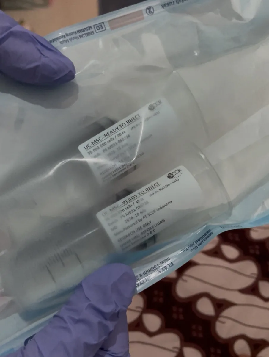Kemasan produk Stem Cell UC-MSC